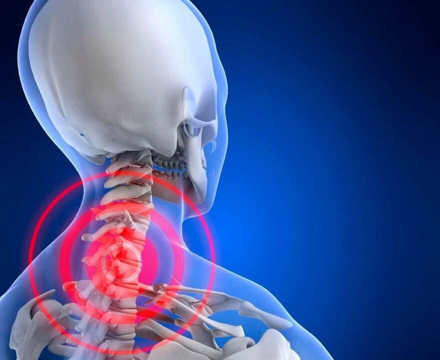 Dolor de cuello y hueso cervical y condrocondrias