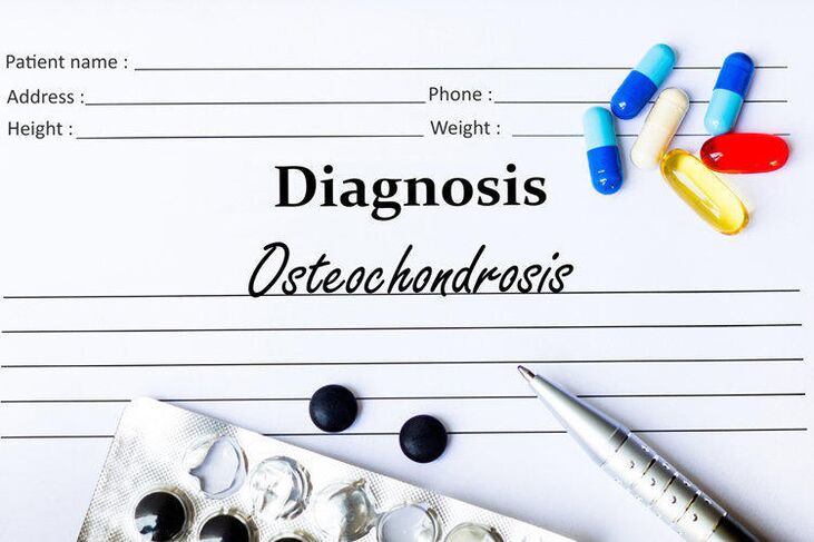 Medicamentos para diagnosticar la osteocondrosis