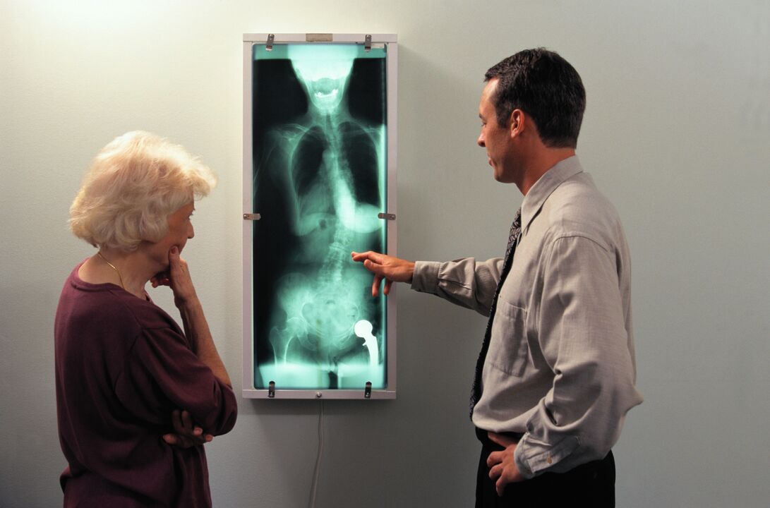 Diagnóstico por rayos X del dolor en las articulaciones de la cadera