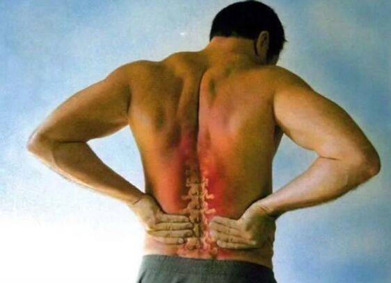 Dolor de la condrosis lumbar